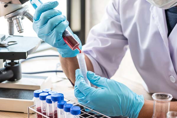 scientist,or,doctor,dropping,a,blood,into,blood,test,tube