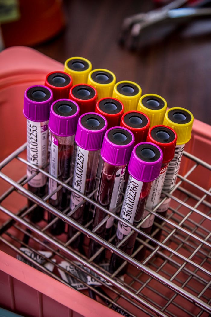 get-in-touch Close-up of colorful blood test tubes in a metal rack for laboratory analysis.