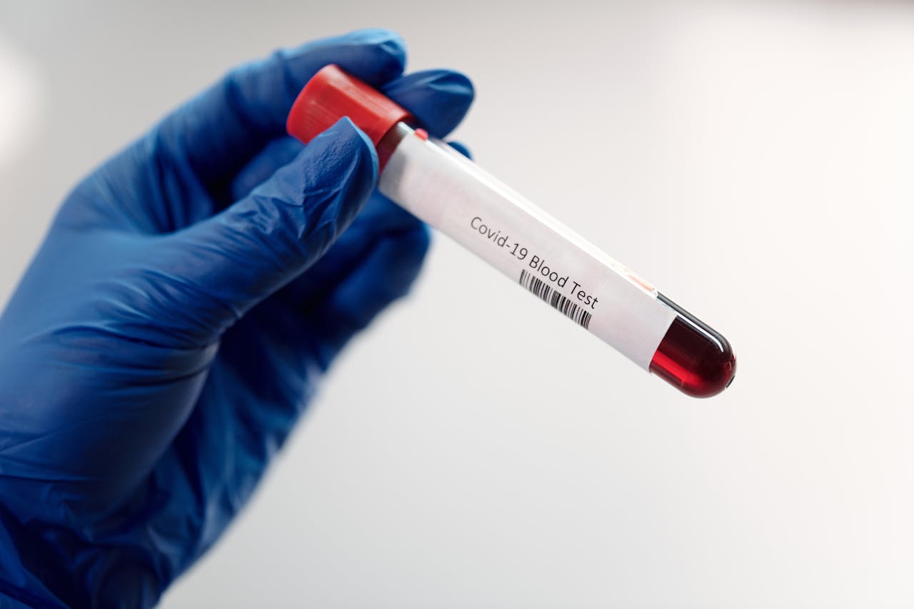 Medical professional holding Covid-19 blood test sample in laboratory, highlighting healthcare research.