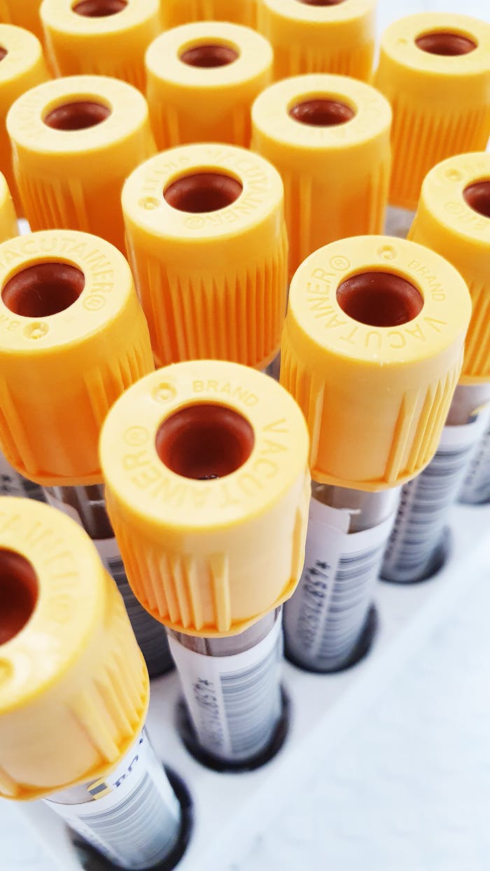 Close-up view of blood collection vials with yellow caps, ideal for medical and laboratory themes.