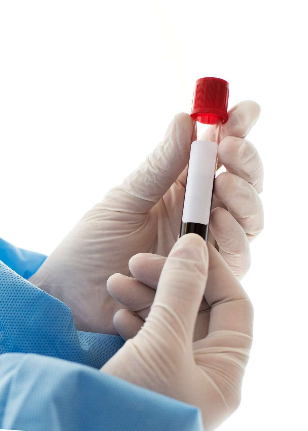 surgeon holding coronavirus blood test tube